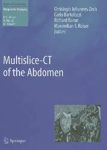 Cover of Multislice-CT of the Abdomen