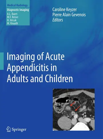 Cover of Imaging of Acute Appendicitis in Adults and Children