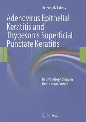Cover of Adenovirus Epithelial Keratitis and Thygeson's Superficial Punctate Keratitis