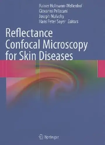 Cover of Reflectance Confocal Microscopy for Skin Diseases