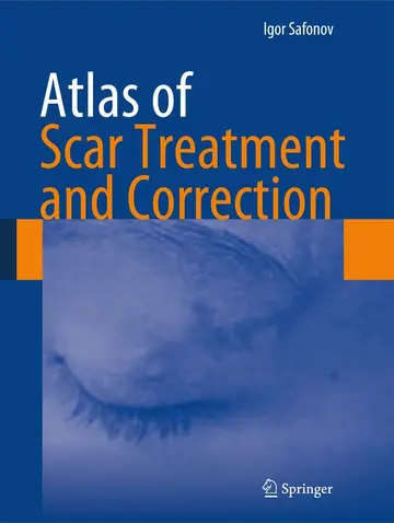Cover of Atlas of Scar Treatment and Correction