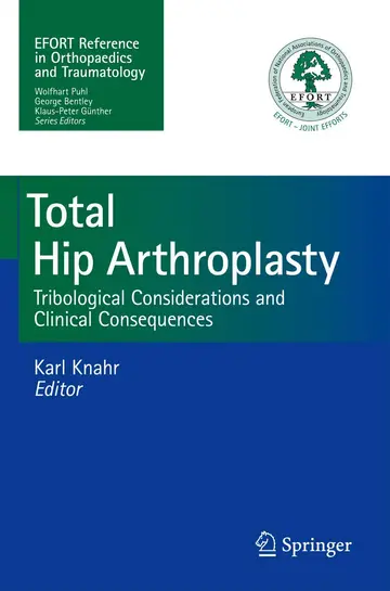 Cover of Total Hip Arthroplasty Tribological Considerations and Clinical Consequences