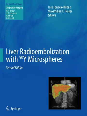 Cover of Liver Radioembolization with 90Y Microspheres