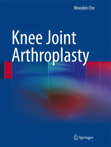 Cover of Knee Joint Arthroplasty 1