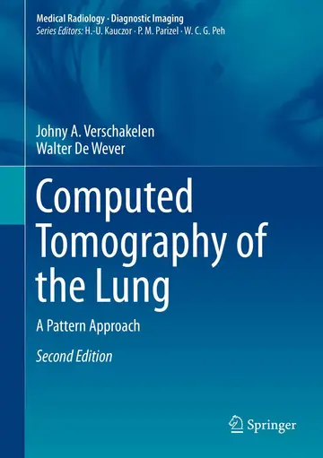 Cover of Computed Tomography of the Lung