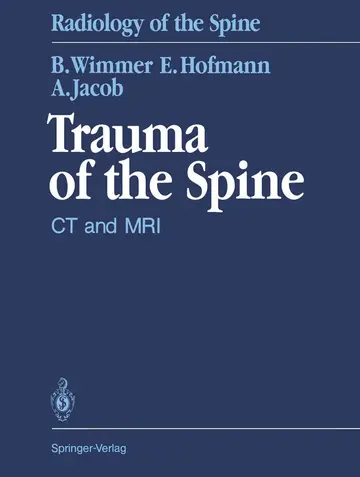 Cover of Trauma of the Spine