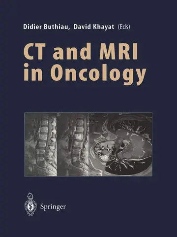 Cover of Ct and MRI in Oncology