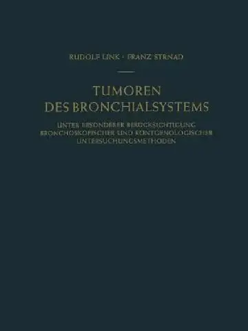 Cover of Tumoren Des Bronchialsystems
