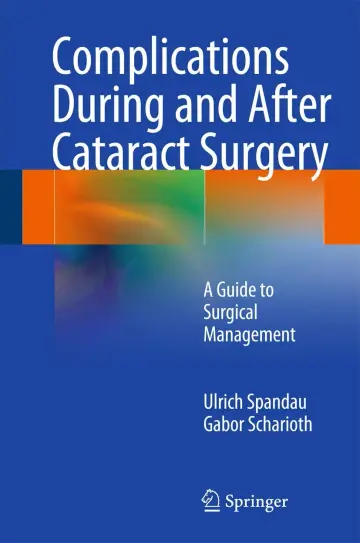 Cover of Complications During and After Cataract Surgery