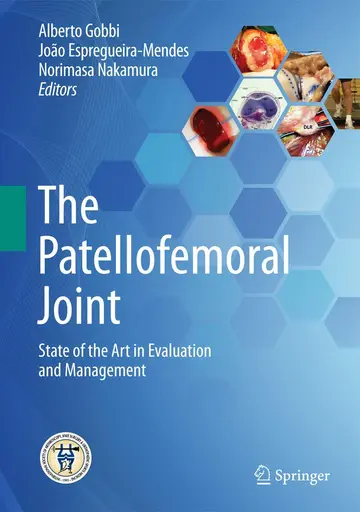 Cover of The Patellofemoral Joint