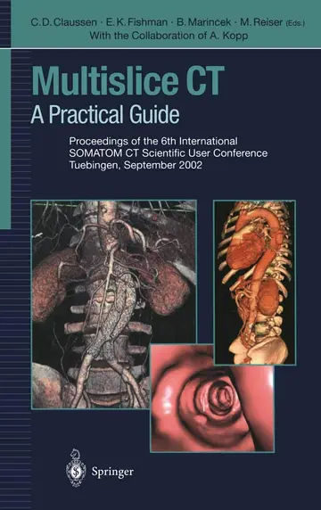 Cover of Multislice Ct