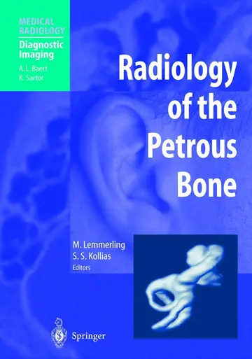 Cover of Radiology of the Petrous Bone