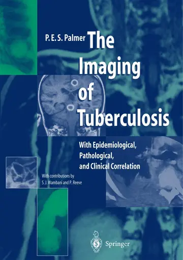 Cover of The Imaging of Tuberculosis