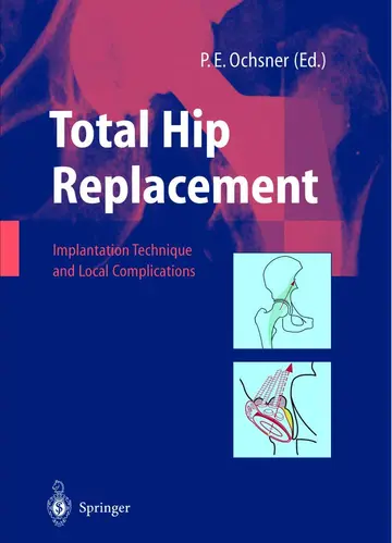 Cover of Total Hip Replacement