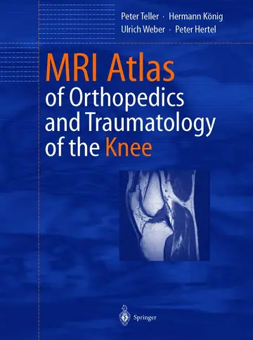 Cover of MRI Atlas of Orthopedics and Traumatology of the Knee