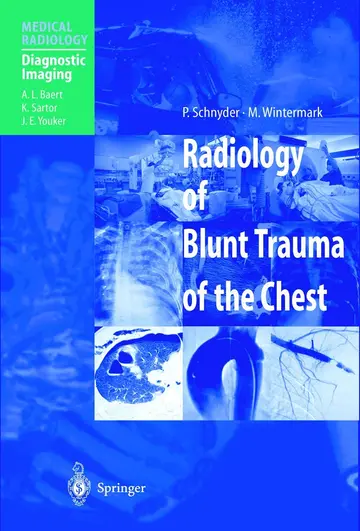 Cover of Radiology of Blunt Trauma of the Chest