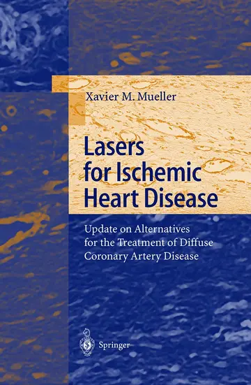 Cover of Lasers for Ischemic Heart Disease