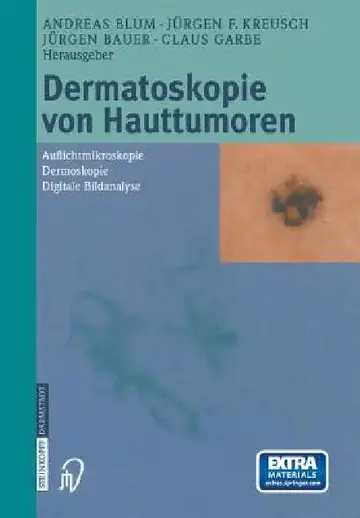 Cover of Dermatoskopie Von Hauttumoren
