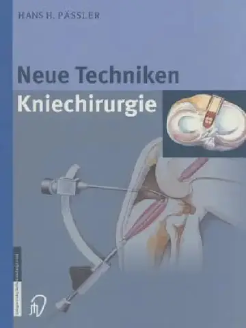 Cover of Neue Techniken Kniechirurgie