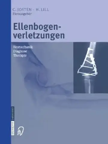Cover of Ellenbogenverletzungen