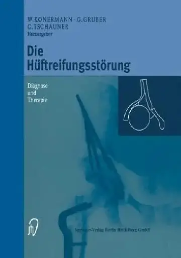 Cover of Die Hüftreifungsstörung