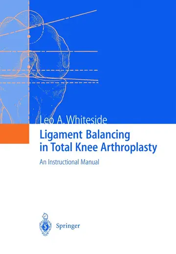 Cover of Ligament Balancing in Total Knee Arthroplasty