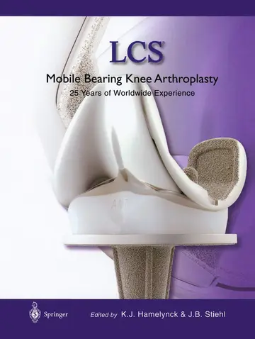 Cover of Lcs Mobile Bearing Knee Arthroplasty