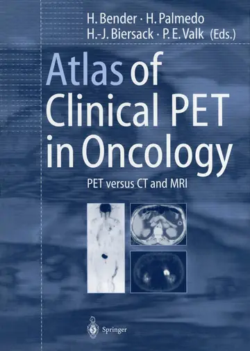 Cover of Atlas of Clinical Pet in Oncology