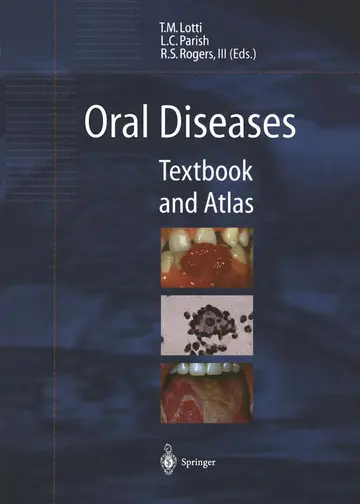Cover of Oral Diseases