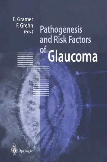 Cover of Pathogenesis and Risk Factors of Glaucoma