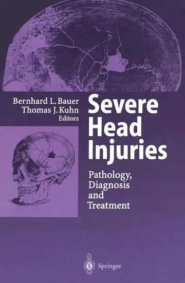 Cover of Severe Head Injuries