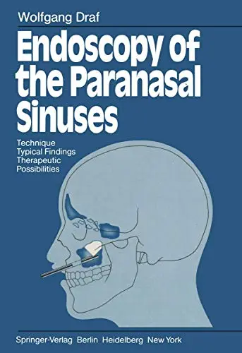 Cover of Endoscopy of the Paranasal Sinuses