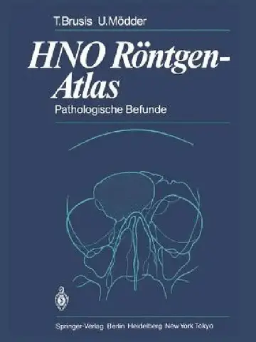 Cover of Hno Röntgen-Atlas