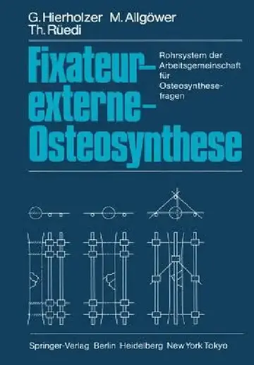 Cover of Fixateur-Externe-Osteosynthese