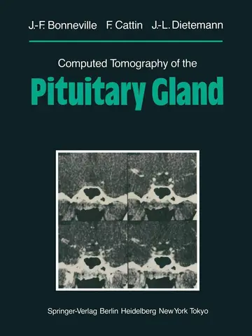Cover of Computed Tomography of the Pituitary Gland