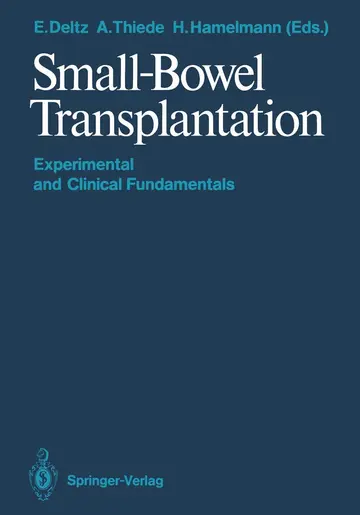 Cover of Small-Bowel Transplantation