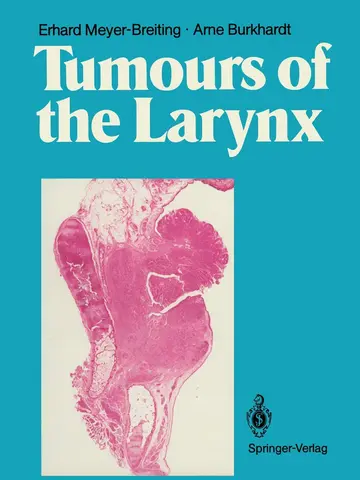 Cover of Tumours of the Larynx