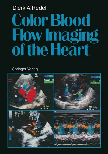Cover of Color Blood Flow Imaging of the Heart