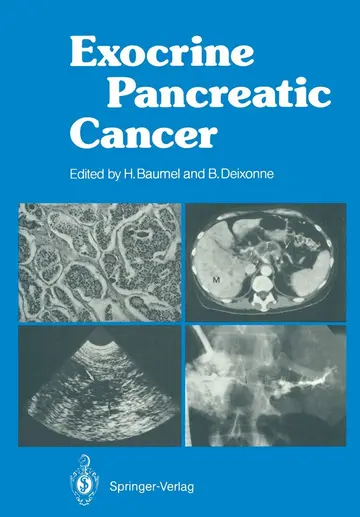 Cover of Exocrine Pancreatic Cancer