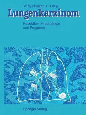 Cover of Lungenkarzinom