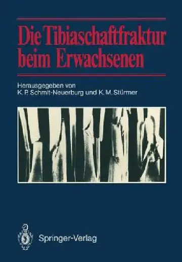 Cover of Die Tibiaschaftfraktur Beim Erwachsenen