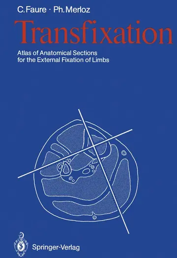 Cover of Transfixation