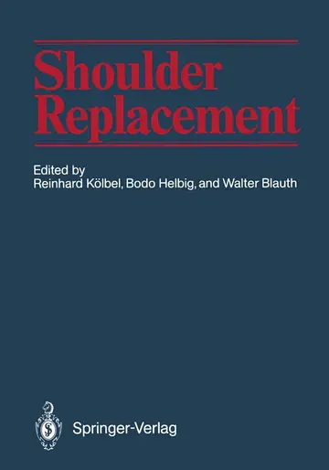 Cover of Shoulder Replacement