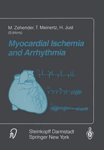 Cover of Myocardial Ischemia and Arrhythmia