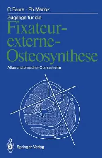 Cover of Zugänge Für Die Fixateur-Externe-Osteosynthese