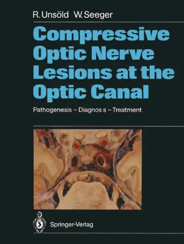 Cover of Compressive Optic Nerve Lesions at the Optic Canal