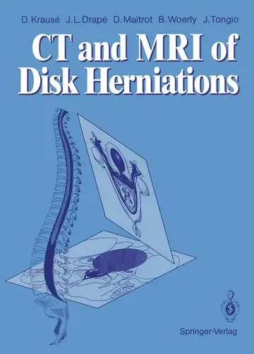 Cover of CT and MRI of Disk Herniations