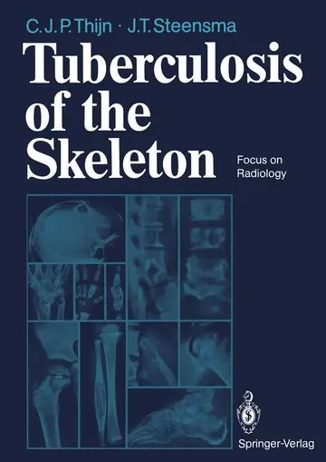 Cover of Tuberculosis of the Skeleton