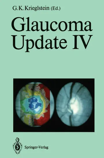 Cover of Glaucoma Update IV