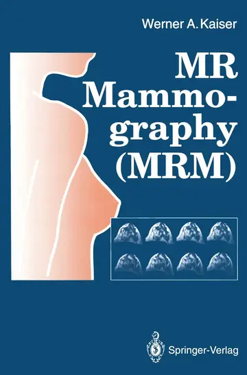 Cover of Mr Mammography Mrm